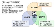 むし歯になる3つの原因