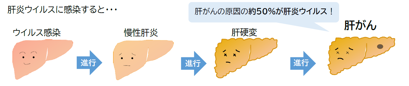 ウイルス性肝炎の経過